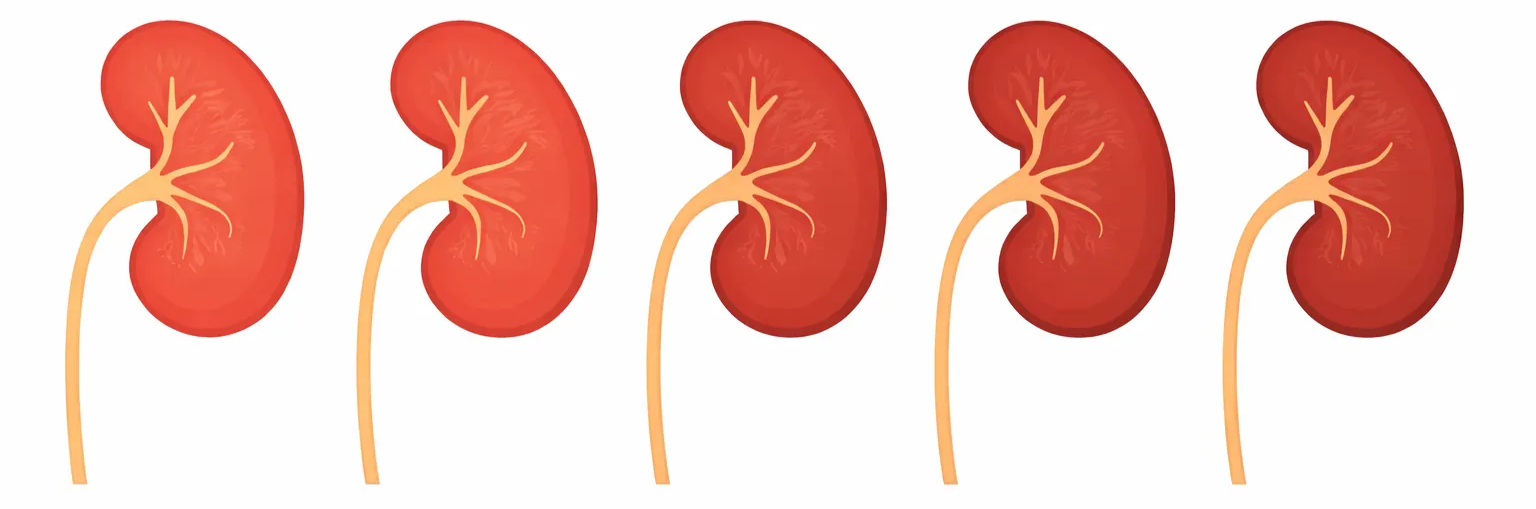CNI progressie die stopt bij gerichte opvolging
